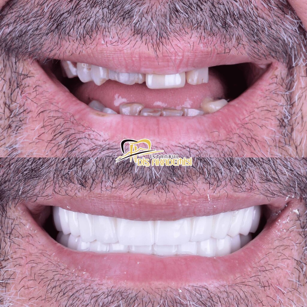 Before - After Dental.