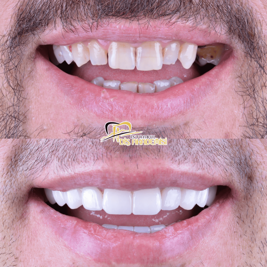 Before - After Dental.