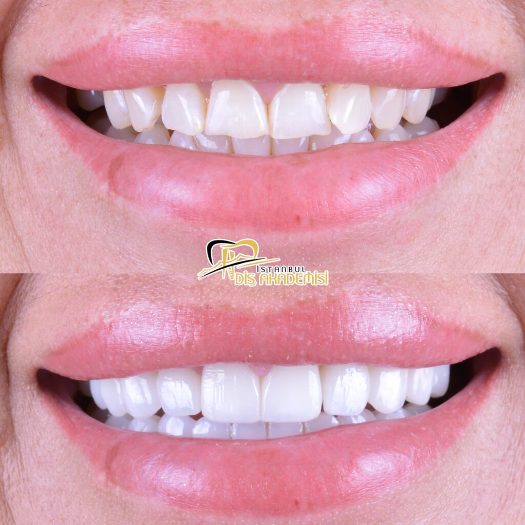Before - After Dental.
