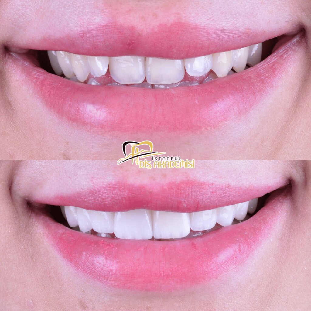 Before - After Dental.