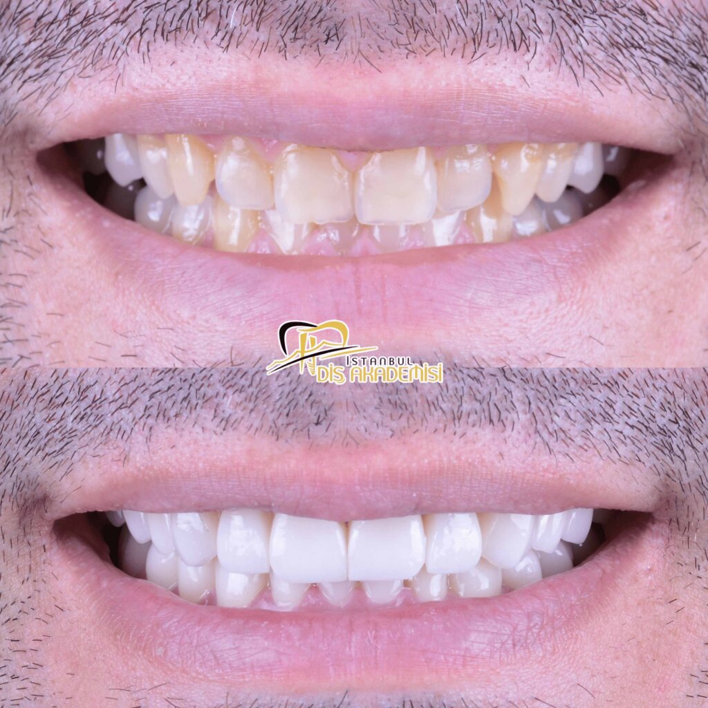 Before - After Dental.
