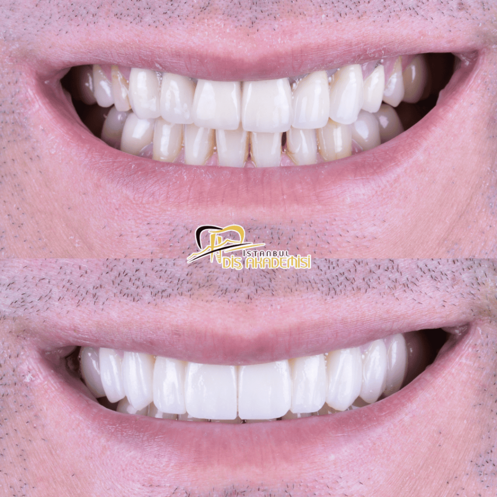 Before - After Dental.