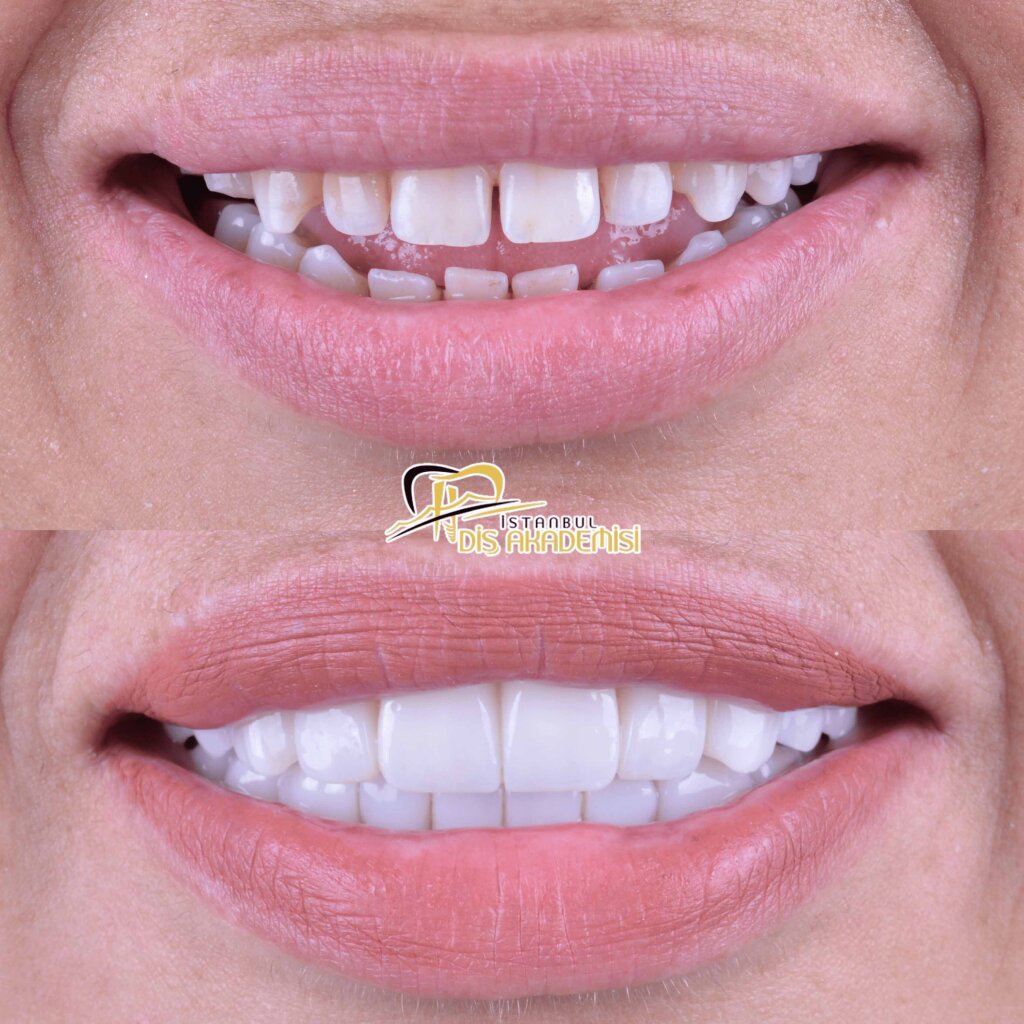 Before - After Dental.