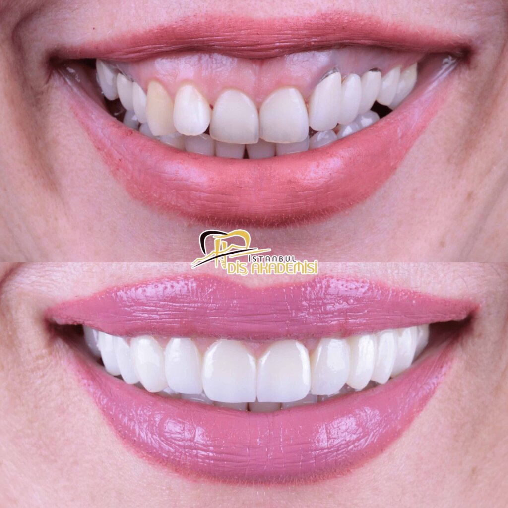 Before - After Dental.