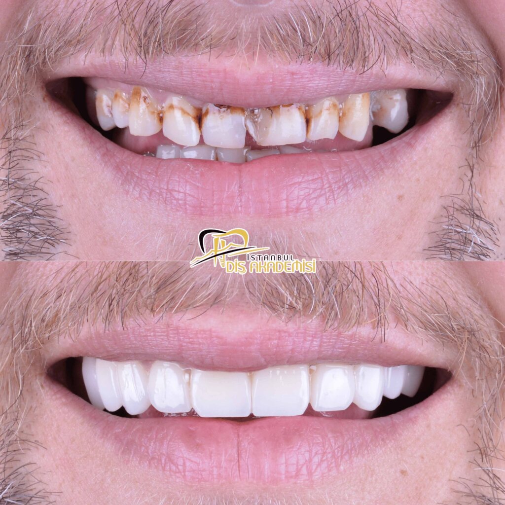Before - After Dental.