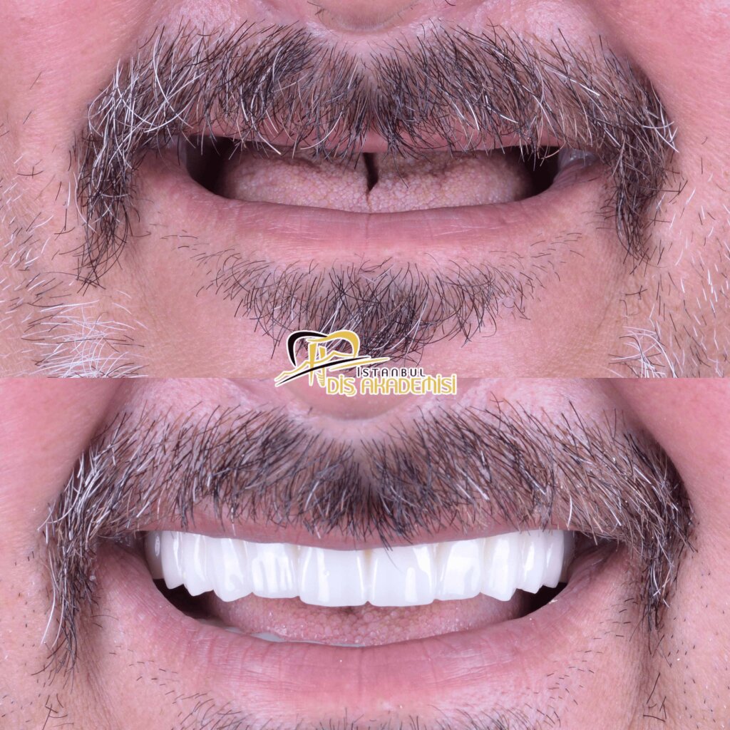 Before - After Dental.