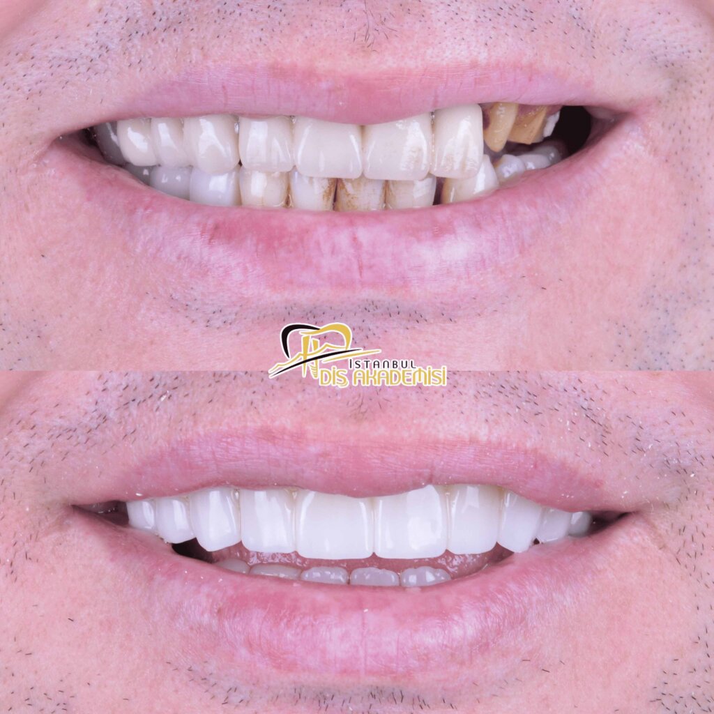 Before - After Dental.