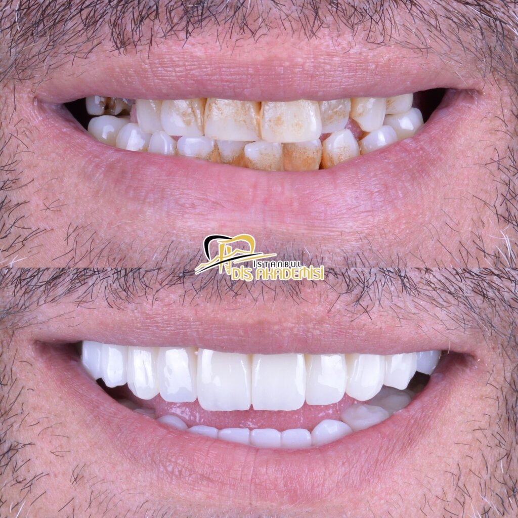 Before - After Dental.