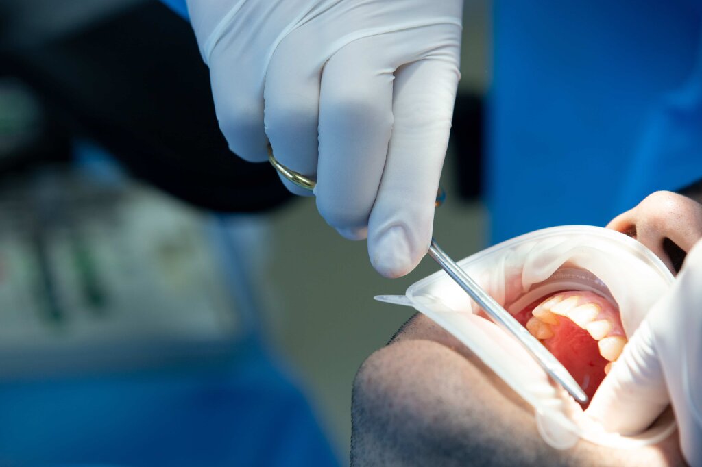 all on 6 implant tedavisi.