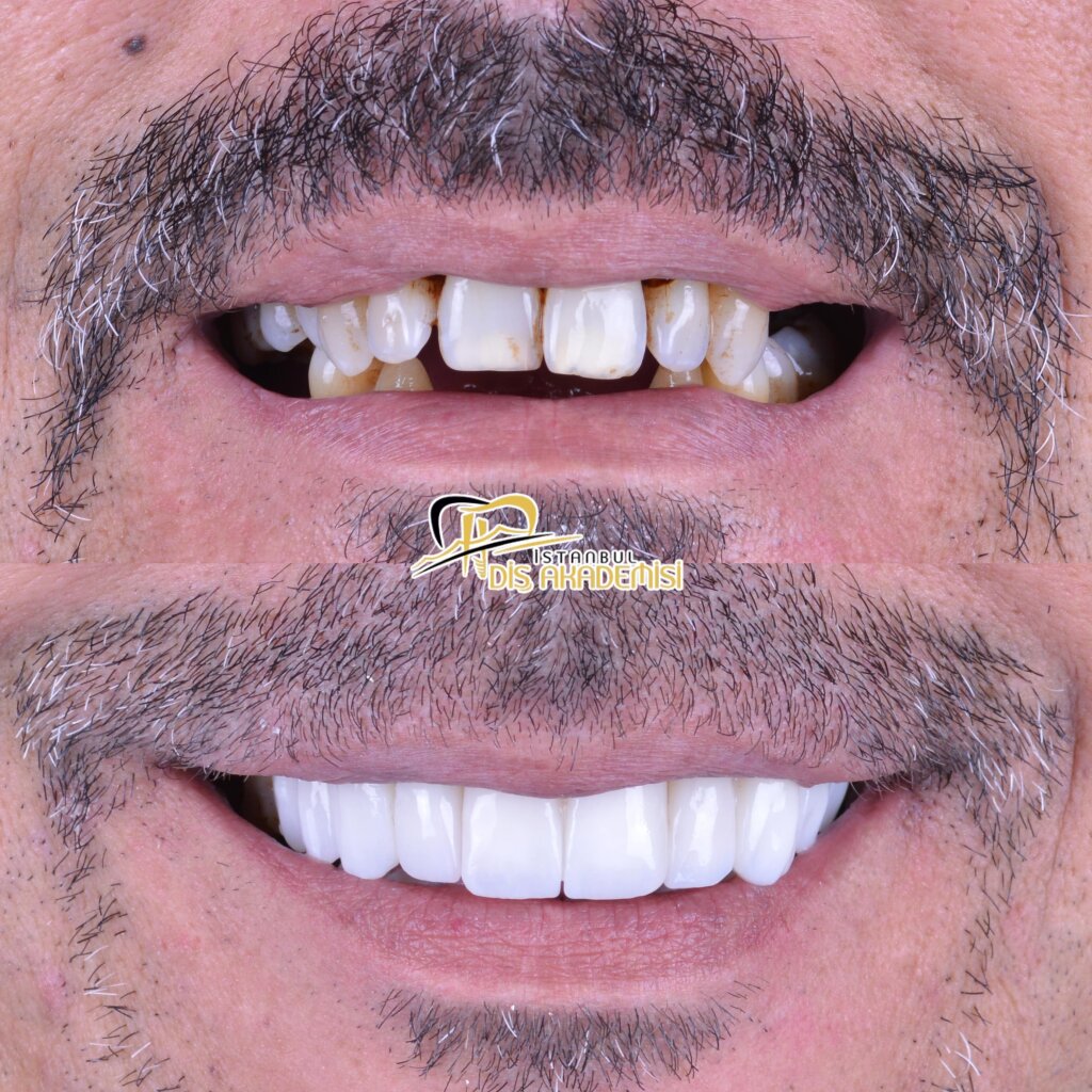 Before - After Dental.